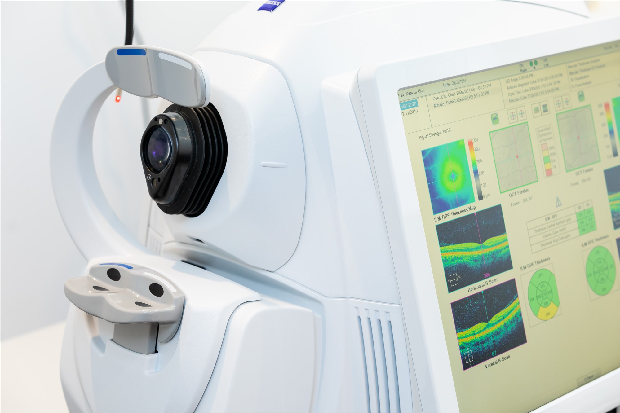 Diagnostic retinal imaging equipment